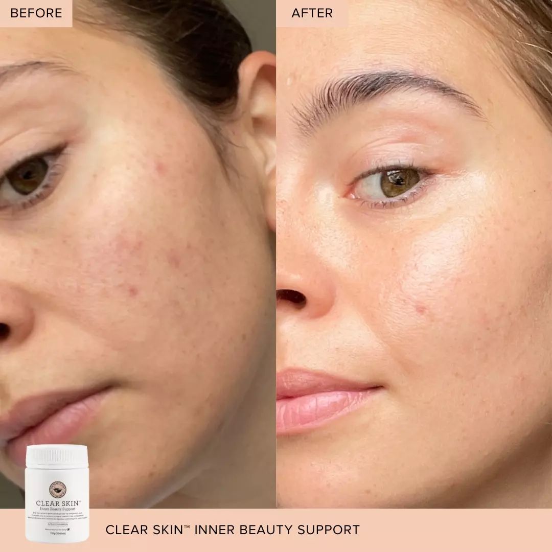 The Beauty Chef Clear Skin™