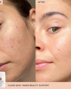 The Beauty Chef Clear Skin™